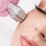 پاکسازی پوست با میکرودرم