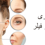 ماندگاری بوتاکس و فیلر